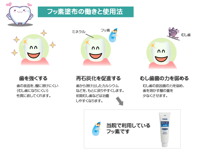 フッ素塗布